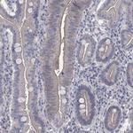 TMEM198 Polyclonal Antibody