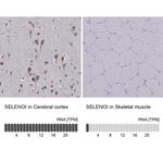 Seli Antibody in Immunohistochemistry (Paraffin) (IHC (P))
