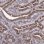 Seli Antibody in Immunohistochemistry (Paraffin) (IHC (P))