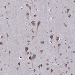 Seli Antibody in Immunohistochemistry (Paraffin) (IHC (P))