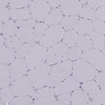 Seli Antibody in Immunohistochemistry (Paraffin) (IHC (P))
