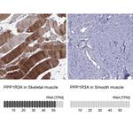 PPP1R3A Polyclonal Antibody