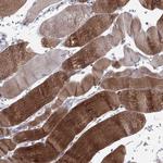 PPP1R3A Antibody in Immunohistochemistry (Paraffin) (IHC (P))