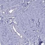 PPP1R3A Antibody in Immunohistochemistry (Paraffin) (IHC (P))