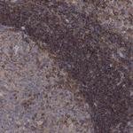 BLOC1S3 Polyclonal Antibody