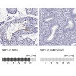 ODF4 Antibody in Immunohistochemistry (Paraffin) (IHC (P))