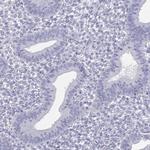 ODF4 Antibody in Immunohistochemistry (Paraffin) (IHC (P))