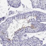 ODF4 Antibody in Immunohistochemistry (Paraffin) (IHC (P))