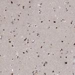 E4F1 Polyclonal Antibody