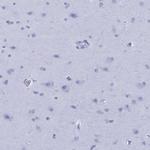 ApoA2 Antibody in Immunohistochemistry (Paraffin) (IHC (P))