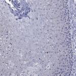 ApoA2 Polyclonal Antibody