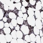 HIAT1 Polyclonal Antibody