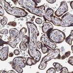 GATSL3 Polyclonal Antibody