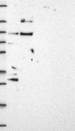 GATSL3 Antibody in Western Blot (WB)