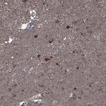 SLC44A1 Polyclonal Antibody