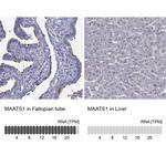 CFAP91 Polyclonal Antibody