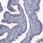CFAP91 Antibody in Immunohistochemistry (Paraffin) (IHC (P))
