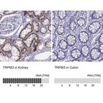 TRPM3 Antibody in Immunohistochemistry (Paraffin) (IHC (P))