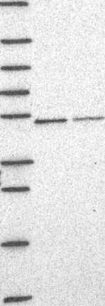 CNOT11 Antibody in Western Blot (WB)