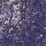 LIMD2 Polyclonal Antibody