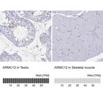 ARMC12 Polyclonal Antibody