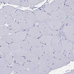 ARMC12 Antibody in Immunohistochemistry (Paraffin) (IHC (P))