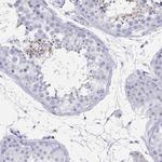 ARMC12 Antibody in Immunohistochemistry (Paraffin) (IHC (P))