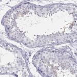 SPATA12 Antibody in Immunohistochemistry (Paraffin) (IHC (P))