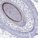 KRT40 Polyclonal Antibody