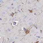 PCDHGC5 Polyclonal Antibody