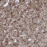 RIM1 Polyclonal Antibody