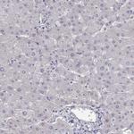 SUN3 Antibody in Immunohistochemistry (Paraffin) (IHC (P))