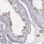 SUN3 Antibody in Immunohistochemistry (Paraffin) (IHC (P))