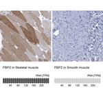 FBP2 Antibody in Immunohistochemistry (Paraffin) (IHC (P))