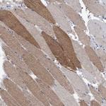 FBP2 Antibody in Immunohistochemistry (Paraffin) (IHC (P))