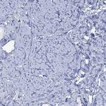 FBP2 Antibody in Immunohistochemistry (Paraffin) (IHC (P))