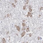 ECEL1 Antibody in Immunohistochemistry (Paraffin) (IHC (P))