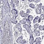RTL1 Polyclonal Antibody