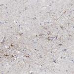 SNTG2 Polyclonal Antibody