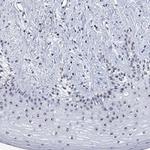 ZNF446 Polyclonal Antibody