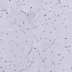 DPY19L2 Antibody in Immunohistochemistry (Paraffin) (IHC (P))