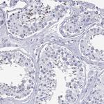 DPY19L2 Antibody in Immunohistochemistry (Paraffin) (IHC (P))