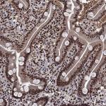 SAP30L Antibody in Immunohistochemistry (Paraffin) (IHC (P))