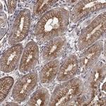 RASEF Antibody in Immunohistochemistry (Paraffin) (IHC (P))