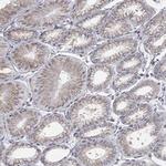 PANK3 Antibody in Immunohistochemistry (Paraffin) (IHC (P))