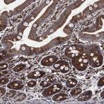 TMCO1 Polyclonal Antibody