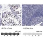 HEATR4 Polyclonal Antibody