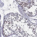 HEATR4 Antibody in Immunohistochemistry (Paraffin) (IHC (P))