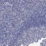 HEATR4 Antibody in Immunohistochemistry (Paraffin) (IHC (P))