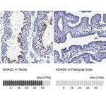 ADAD2 Polyclonal Antibody